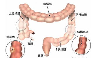 华梵安肿瘤个体化诊疗基因检测